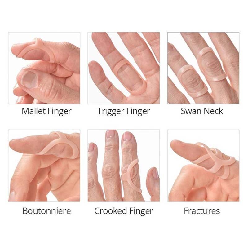 Oval-8 Finger Splint Combo Pack | SME, Inc. USA