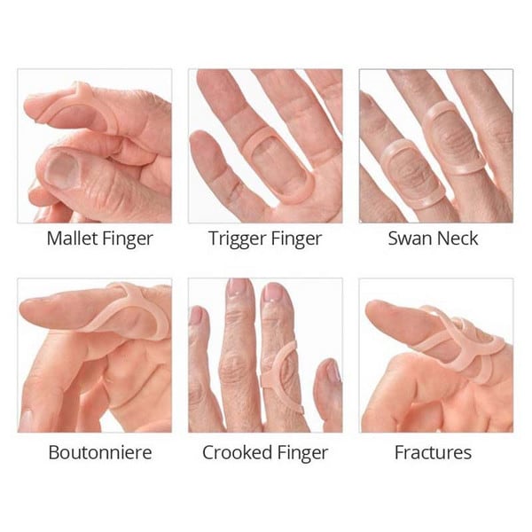 Oval-8 Finger Splint Graduated Set