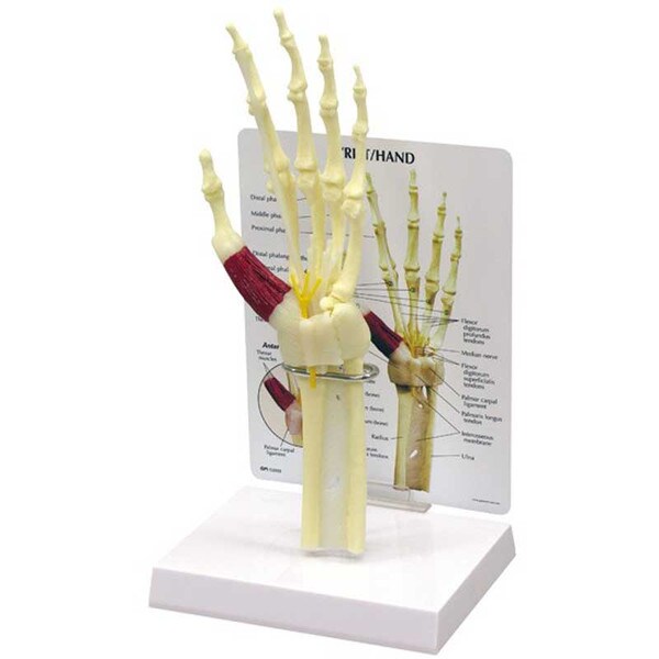 Hand/Wrist w/Carpal Tunnel Model