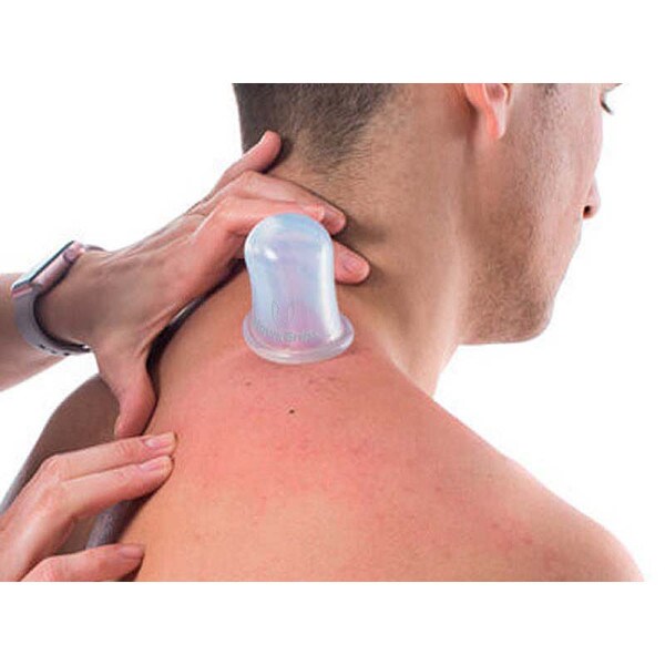 HawkGrips Cupping Set