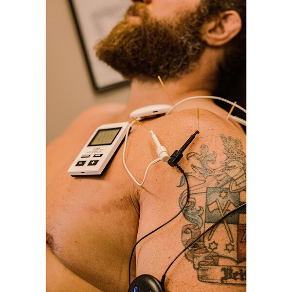 MyoPux Electroacupuncture Unit